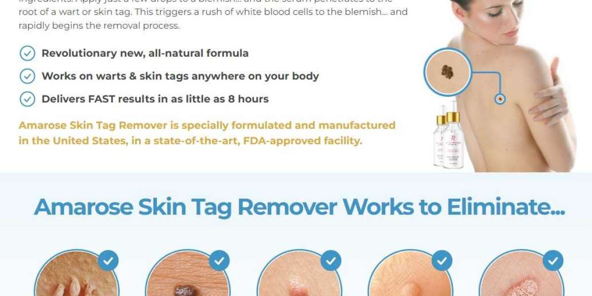 Amarose Skin Tag Remover Review: Does Amarose Skin Tag Remover Work for You?