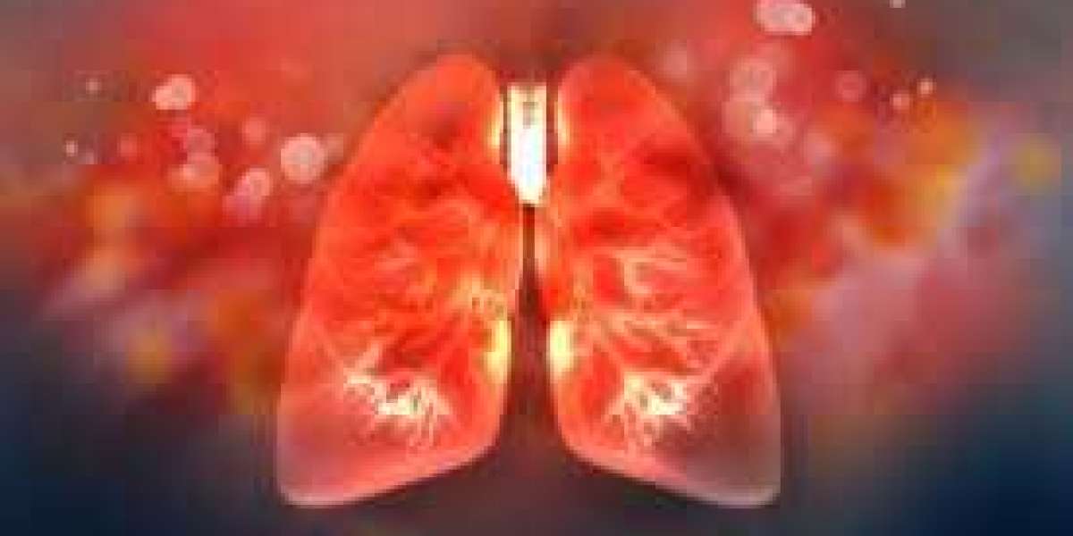 Non-Small Cell Lung Carcinoma (NSCLC) Market is expected to reach US$ 21.40 Billion by 2033 | FMI