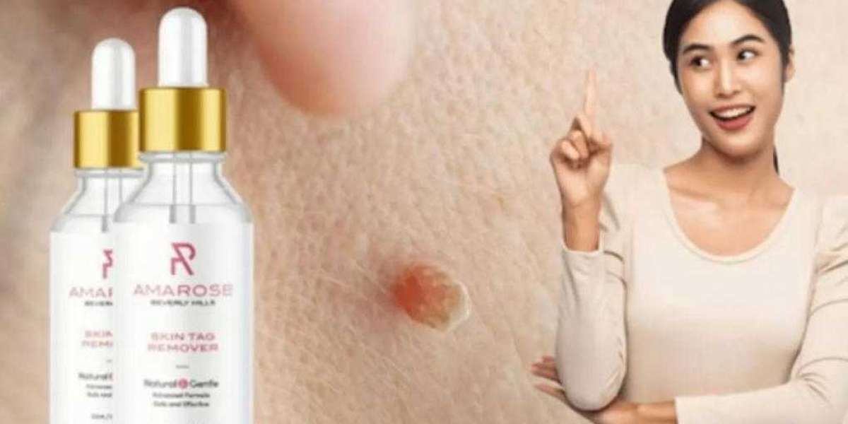 Warning! Super Luxe Skin Tag Remover Reviews- Scam or Ingredients