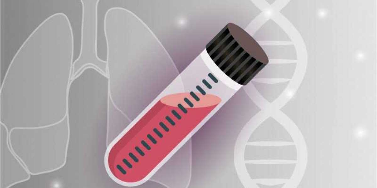 Liquid Biopsy Market Revenue Opportunity, Competitive Analysis and Forecast to 2032