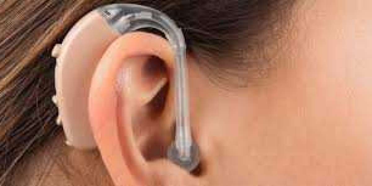 Hearing Aids Market Outlook, Share, Growth, Trends, Revenue, Competitive Landscape, Forecast Report 2030