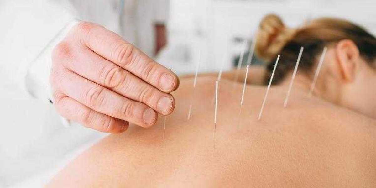 Acupuncture Market Outlook, Statistics, Segment, Trends, Size, Share, Type, Demand and Forecast 2021 to 2030