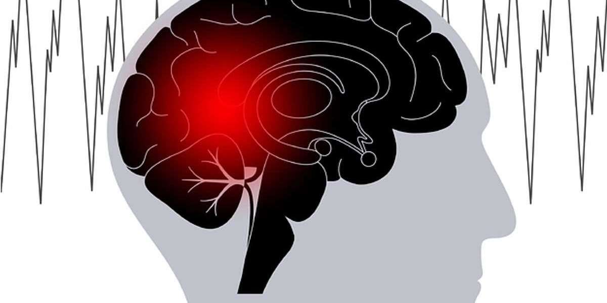 Epilepsy Market Outlook, Information, Figures and Analytical Insights 2022- 2030