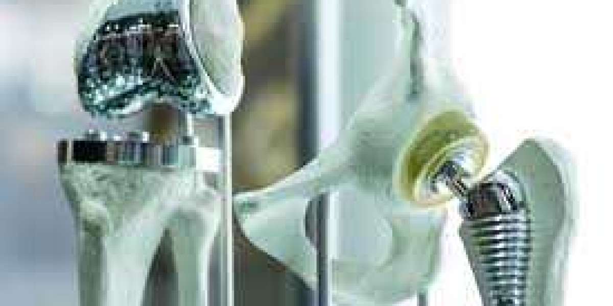 Joint Replacement Market Analysis Based On Manufacturers, Regions, Applications and Types by 2032
