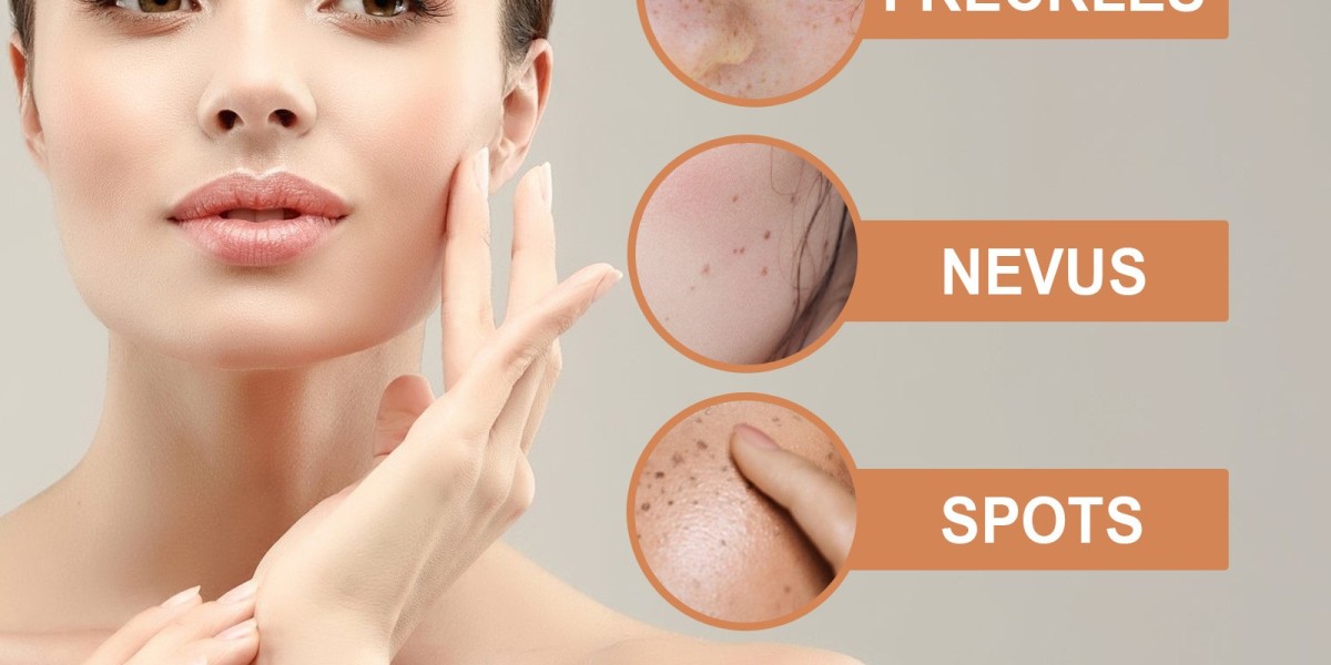 5 Reasons Why Remedy Skin Tag Remover is the Best Solution for Skin Tags