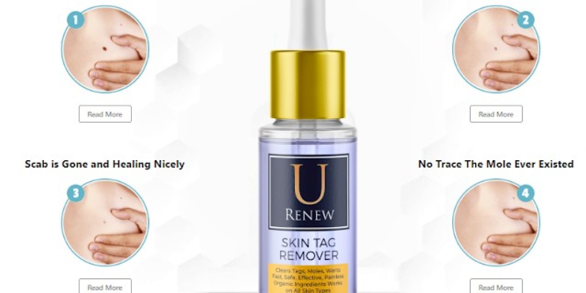Remove Unsightly Skin Tags with U Renew Skin Tag Remover