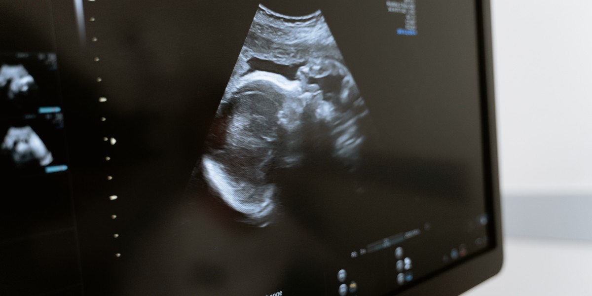 How to choose the best IVF doctor in Dubai?