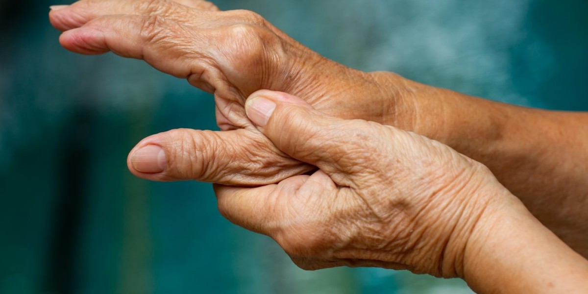 Thumb Arthritis Market: Growing Companies Offering R&D services