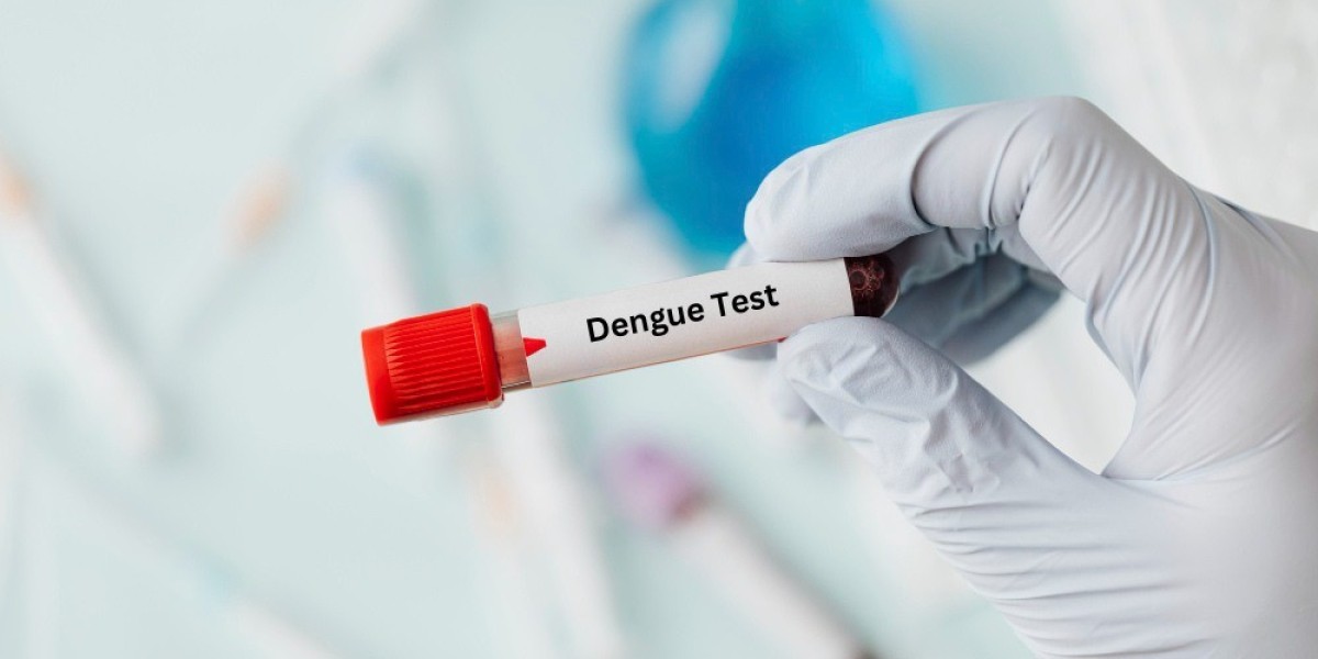 Dengue Test – Price, Procedure, Preparation & Range 2023