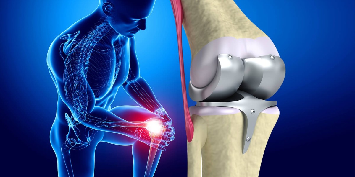 Knee Replacement Market to Worth USD 10.85 Billion Registering 7.60% CAGR By 2030