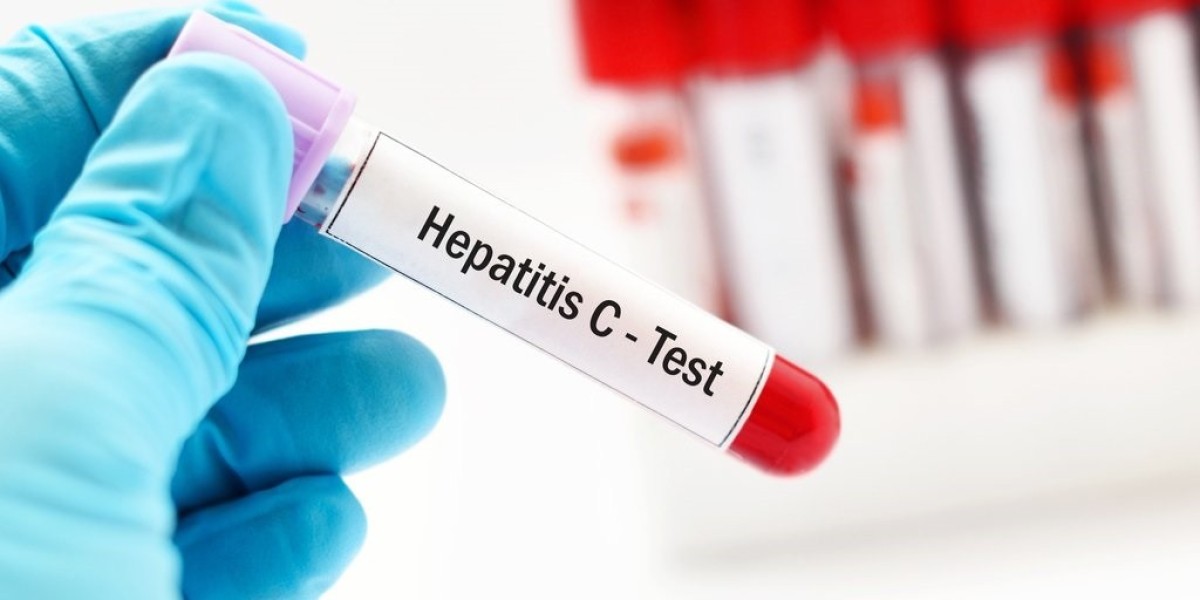 Hepatitis Test Solution Diagnosis Market Can Fetch Revenue at 3.86% CAGR During the Forecast Period (2022-2030): MRFR