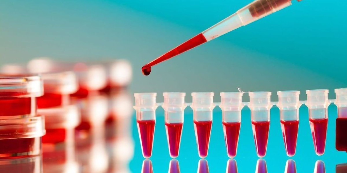 Blood Screening Market Research on Industry To Gain Traction During 2023-2030