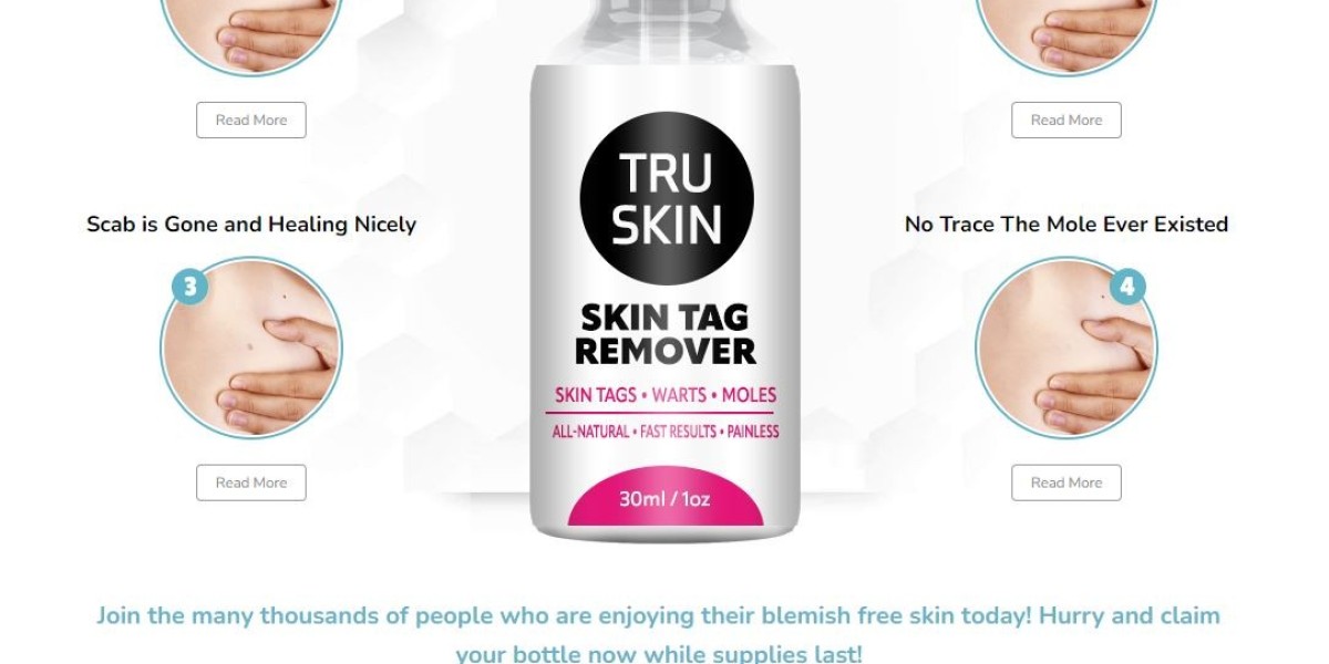 Tru Skin Tag Remover USA: How Does It Work to Bid Farewell to Skin Tags?