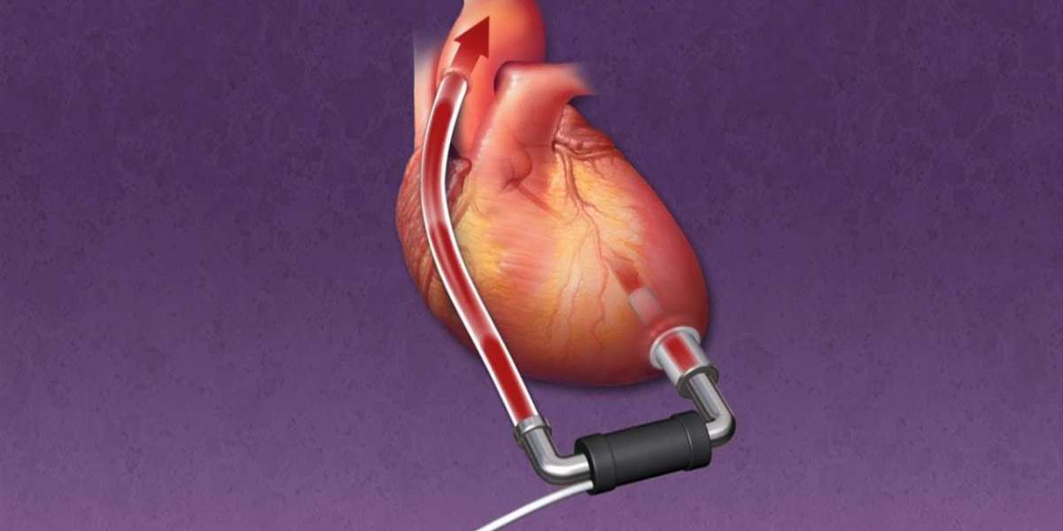 Future Prospects of the Ventricular Assist Devices Market