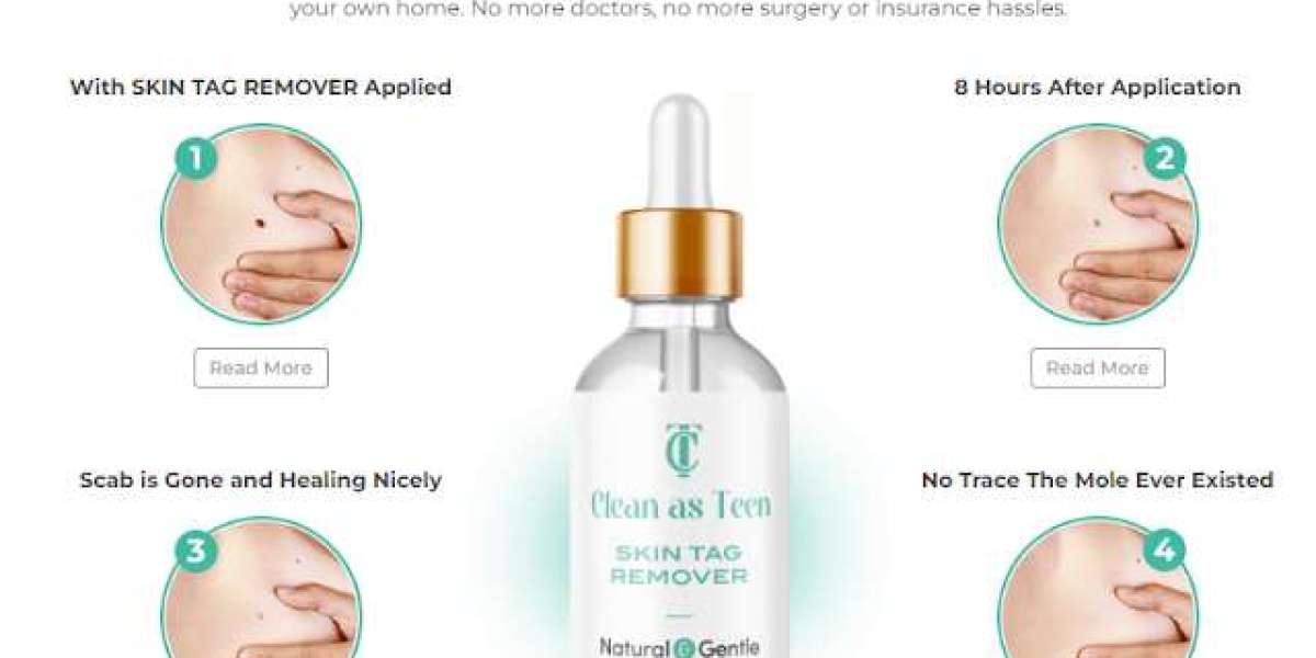 How to Buy Clean As Teen Skin Tag Remover (USA)? Is It Safe?