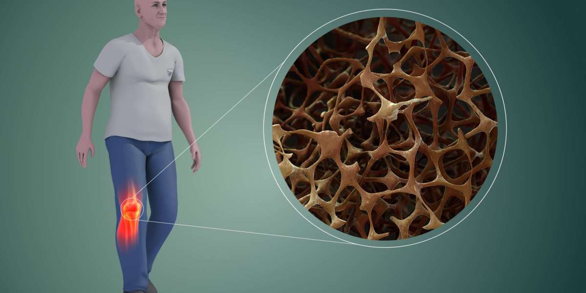 The Osteoporosis Treatment Market is Estimated To Witness High Growth Owing To Growing Geriatric Population