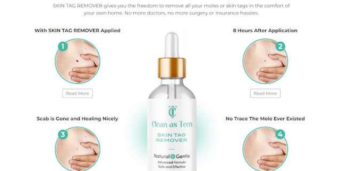 Clean as Teen Skin Tag Remover Serum USA: How Does It Work to Bid Farewell to Skin Tags?
