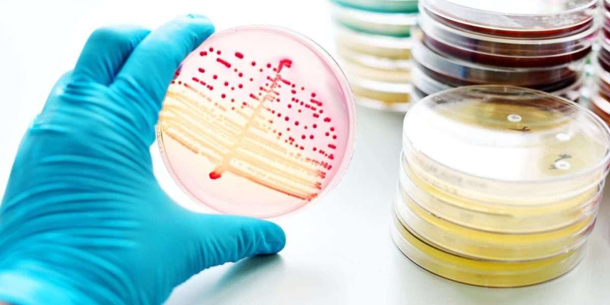 Antimicrobial Plastics Segment is the largest segment driving the growth of Antimicrobial Additives market