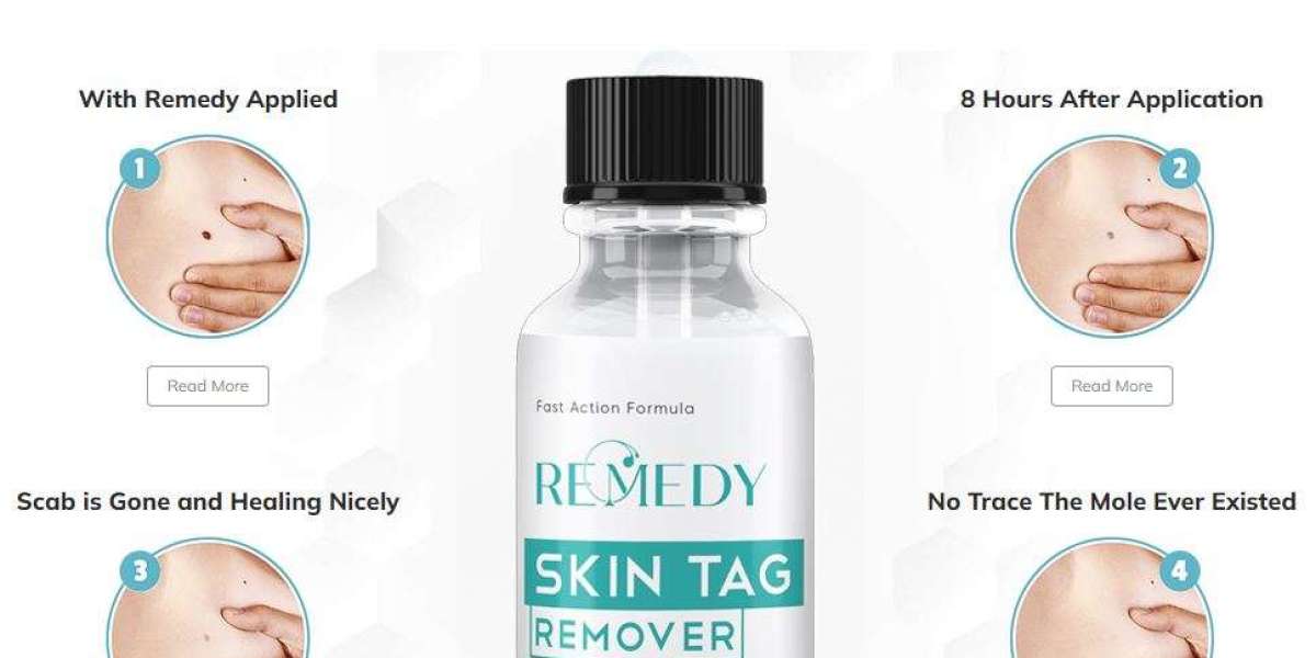 Remedy Skin Tag Remover USA: How Does It Work to Bid Farewell to Skin Tags?