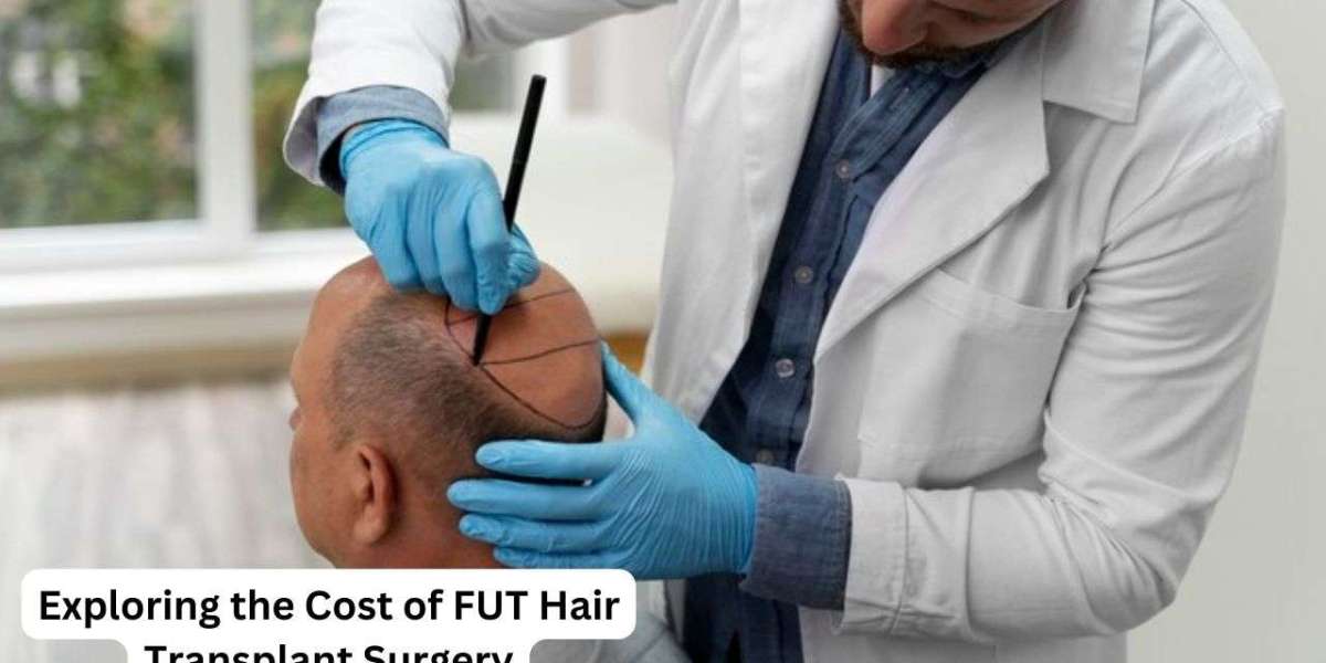 Exploring the Cost of FUT Hair Transplant Surgery
