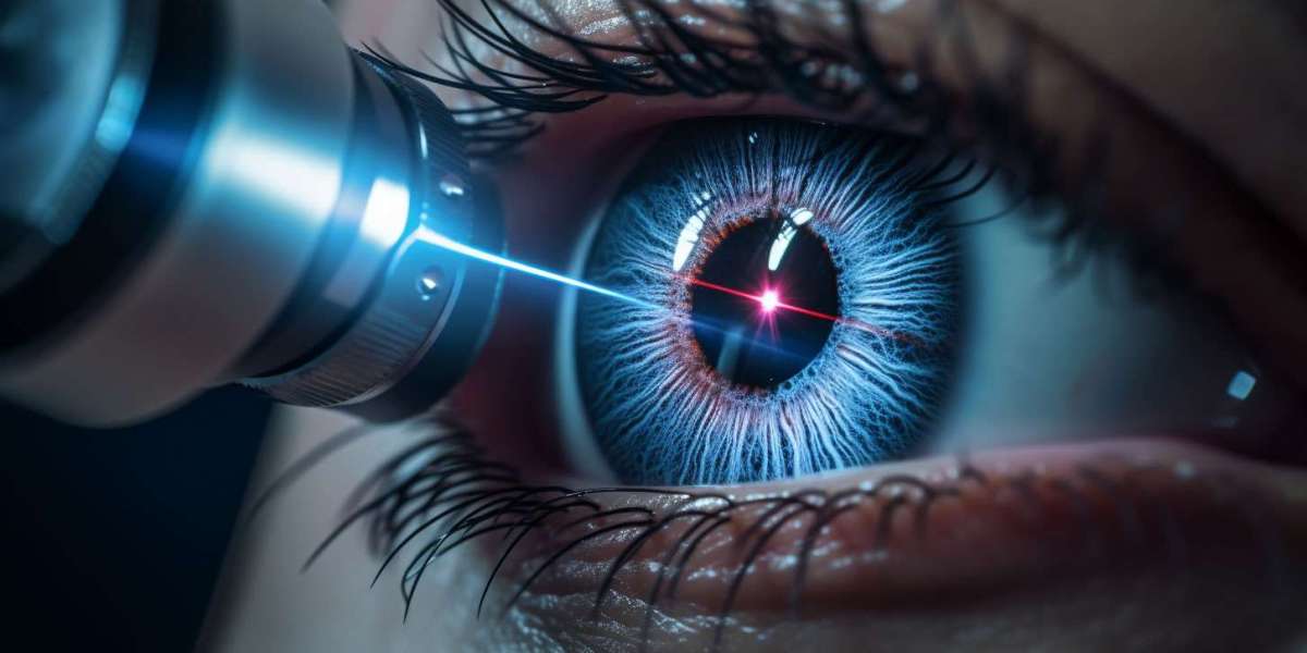 Understanding Laser Surgery For Eyes