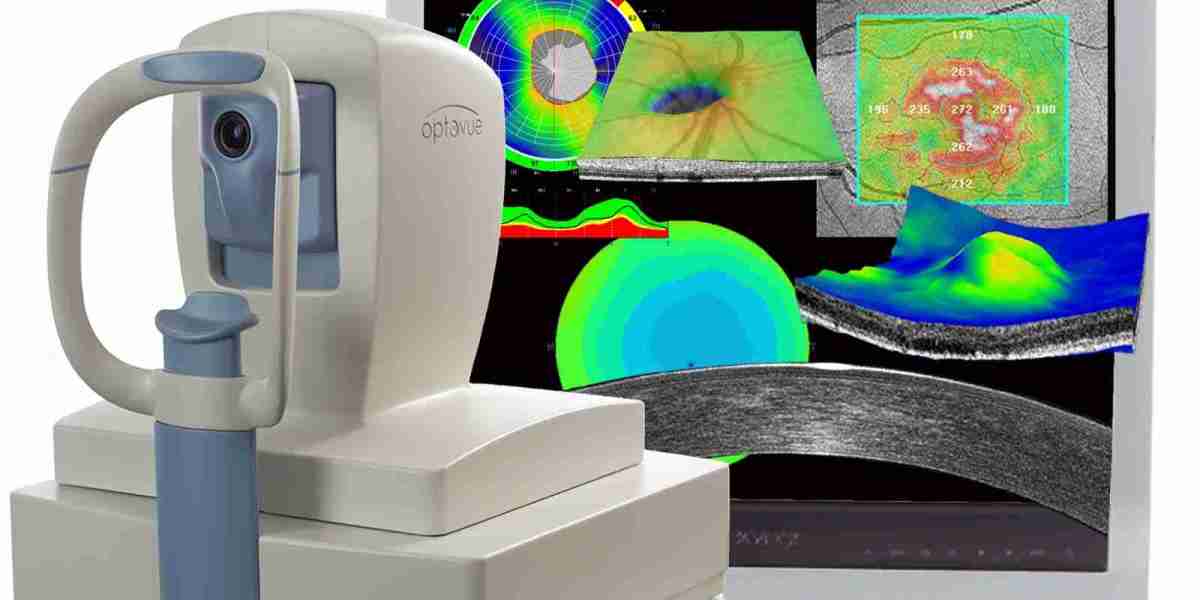 Optical Coherence Tomography Market Size, Trend & Share 2033