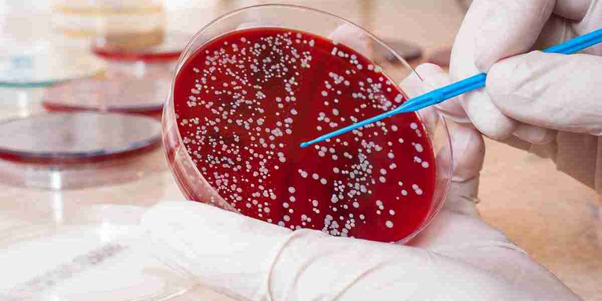 Forecasting the Future: Staphylococcus Aureus Testing Market Trends for 2033